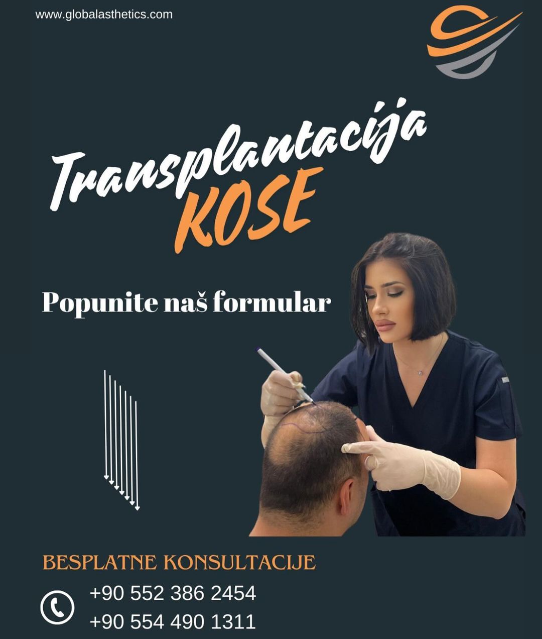 transplatcaija_kose